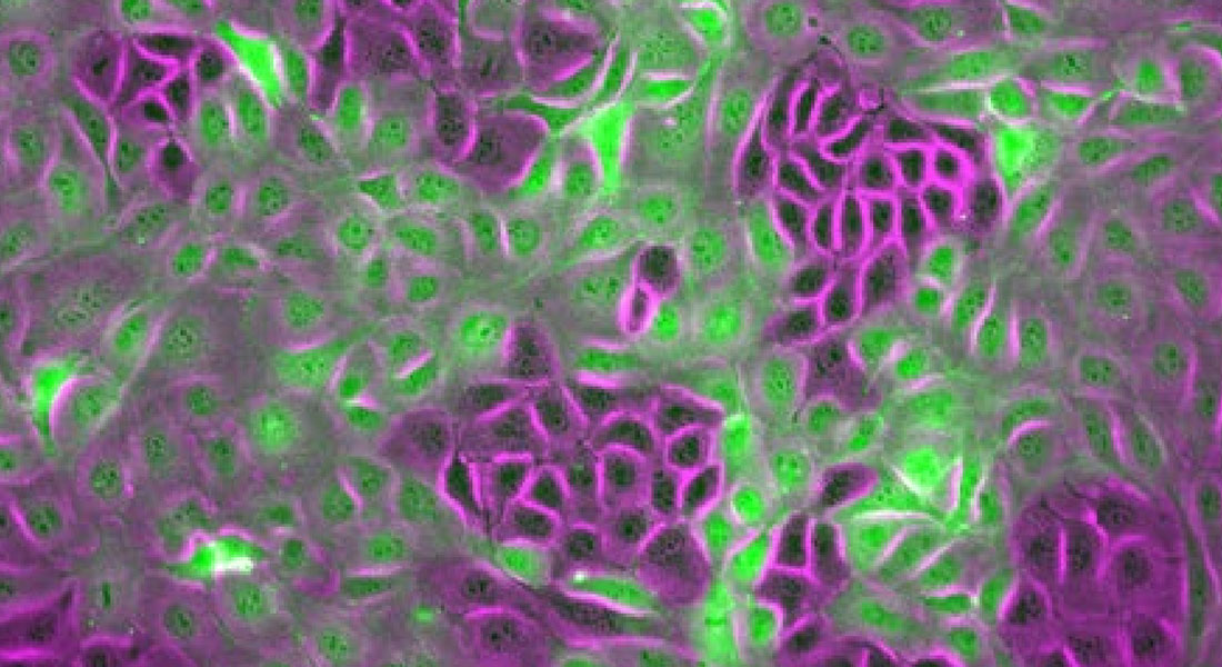 Mixed cell population