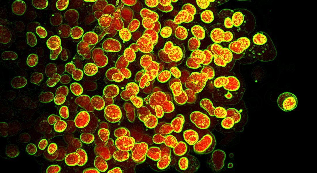 Fusion of membrane vesicles using optically trapped plasmonic nanoparticles.