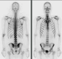 Røntgenbilleder af et menneske
